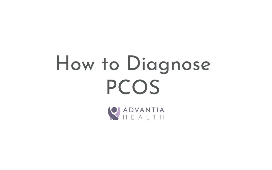 How to Diagnose PCOS | Patient FAQs