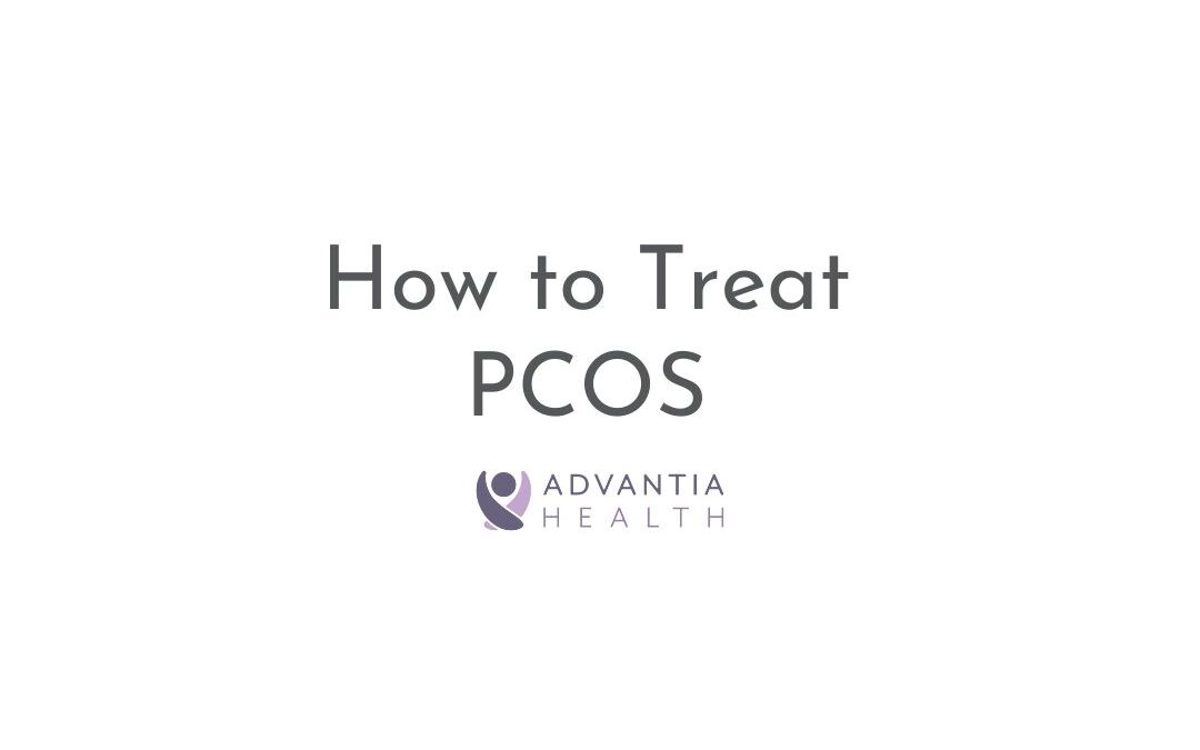 How to Treat PCOS | Patient FAQs