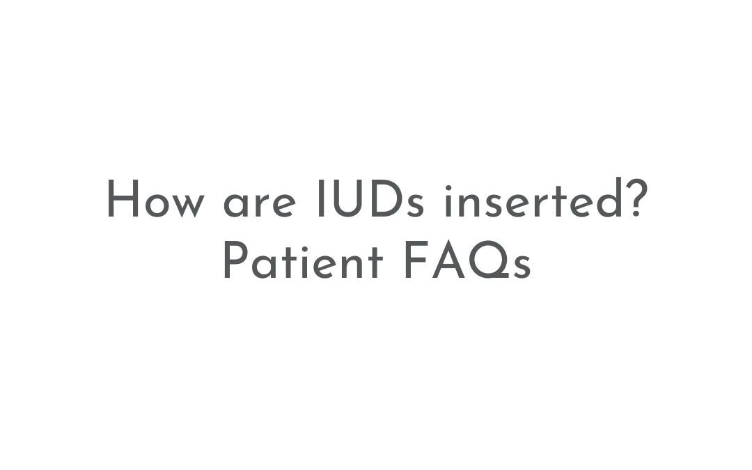 How are IUDs inserted? | Patient FAQs